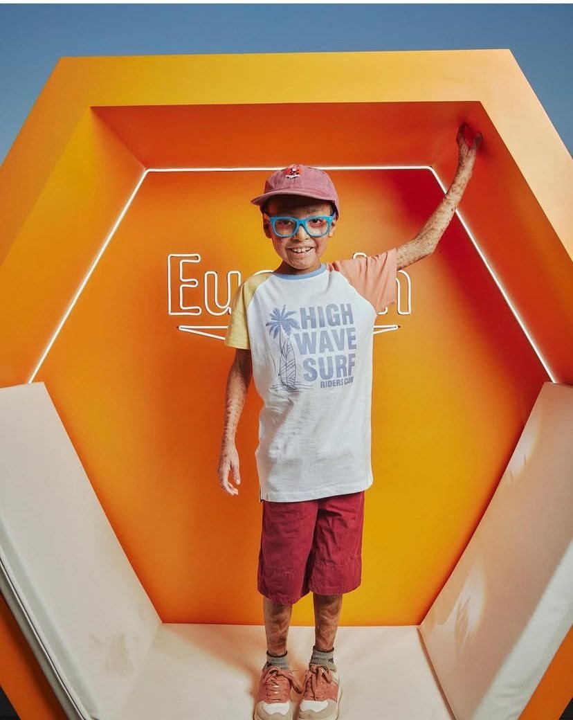 Junge steht in einem orangefarbenen, mit Eucerin gebrandeten Ausstellungswürfel, hebt einen Arm und zeigt sichtbare Hautveränderungen an Arm und Beinen.