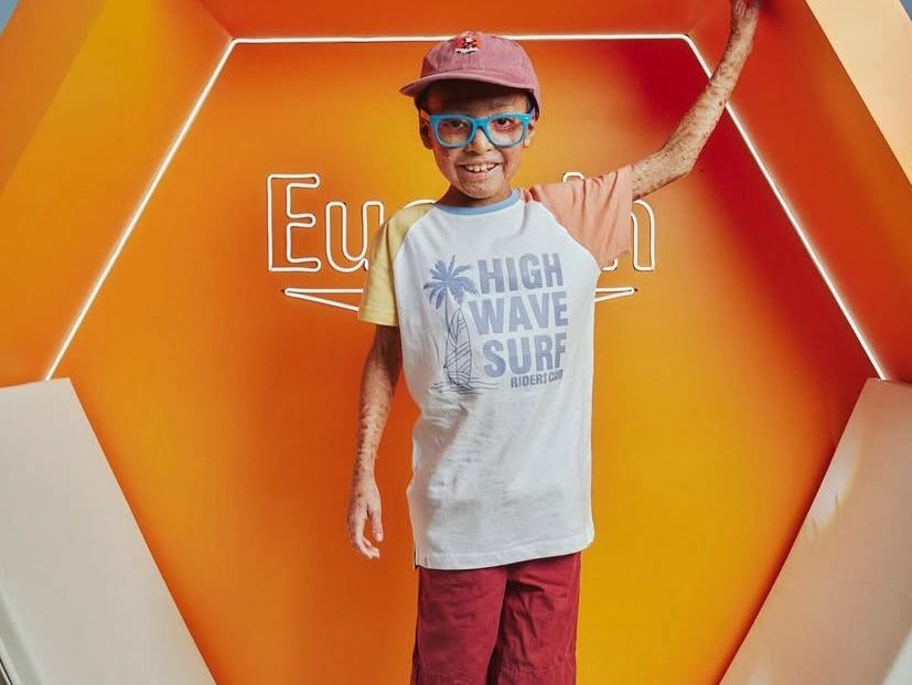 Junge steht in einem orangefarbenen, mit Eucerin gebrandeten Ausstellungswürfel, hebt einen Arm und zeigt sichtbare Hautveränderungen an Arm und Beinen.